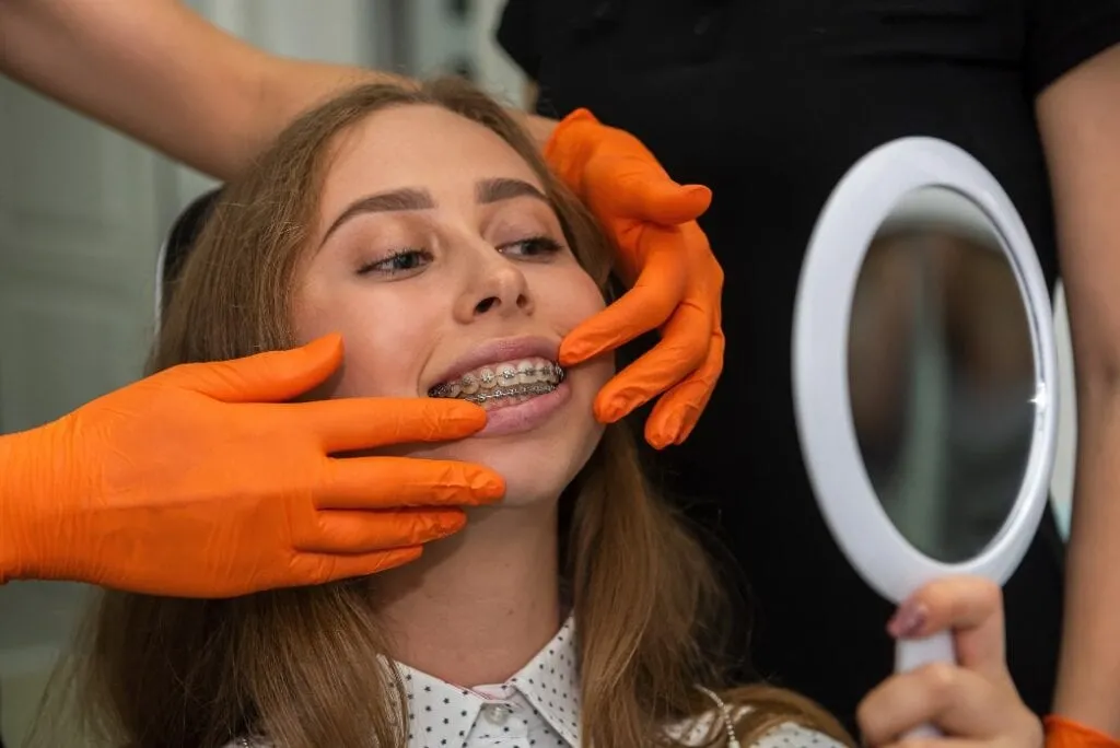 Braces Palos Verdes Estates, CA