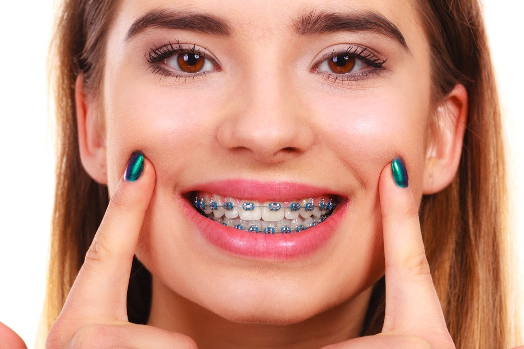 Teens with braces
